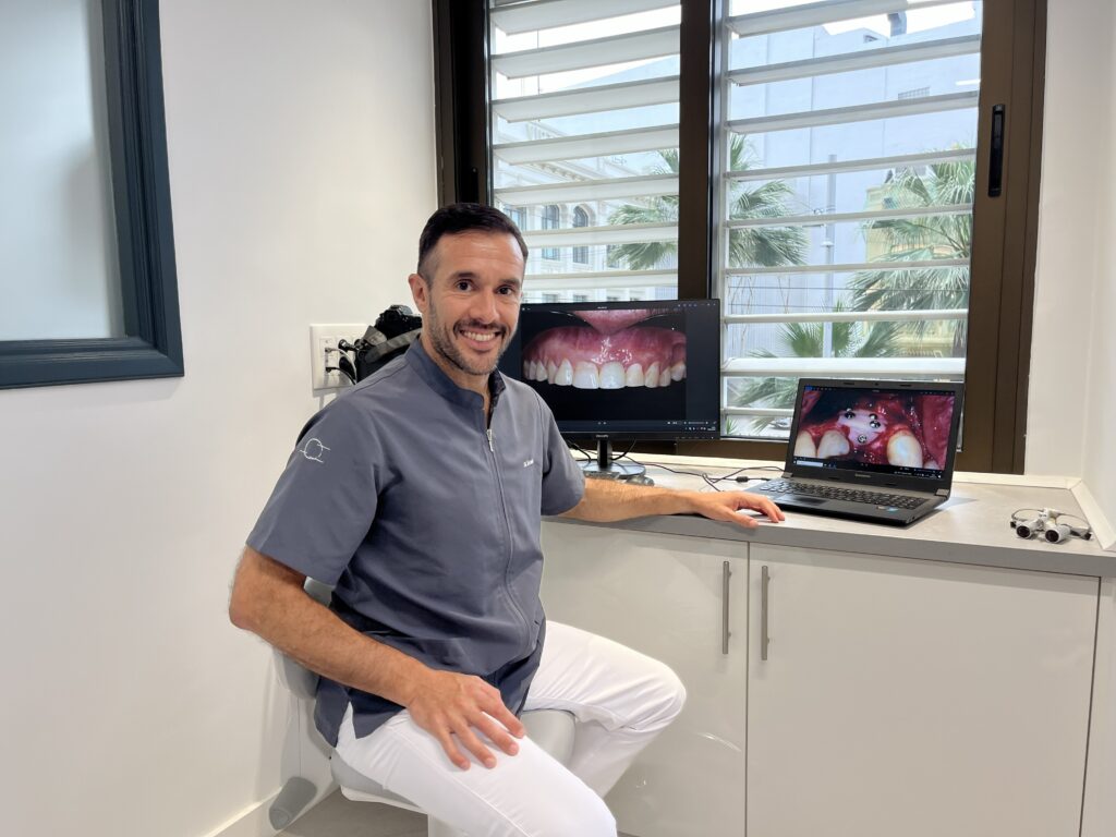 Implantes dentales: mitos, realidades y claves para un tratamiento exitoso